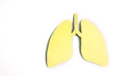 Transbronchial Cryobiopsy