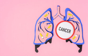 Lung Cancer